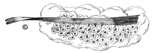 Fig. 65. "Frog spawn."