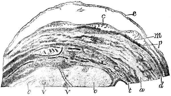 Pemphigus bulla from a new-born syphilitic child