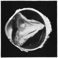 cross-section of eye