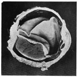 cross-section of eye