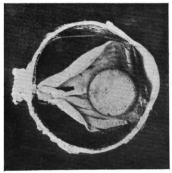 cross-section of eye