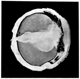 cross-section of eye