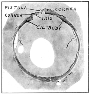 cross-section of eye