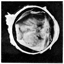 cross-section of eye