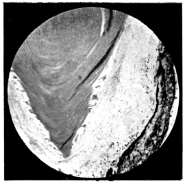 cross-section of eye