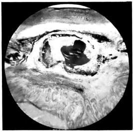 cross-section of eye