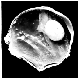 cross-section of eye