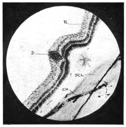 cross-section of eye