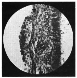 cross-section of eye