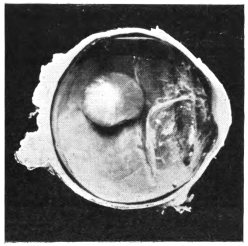 cross-section of eye